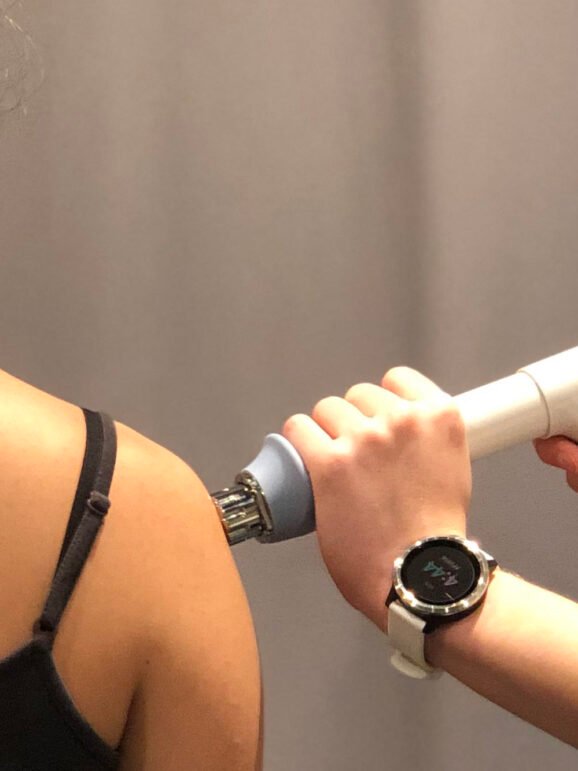 shockwave-therapy